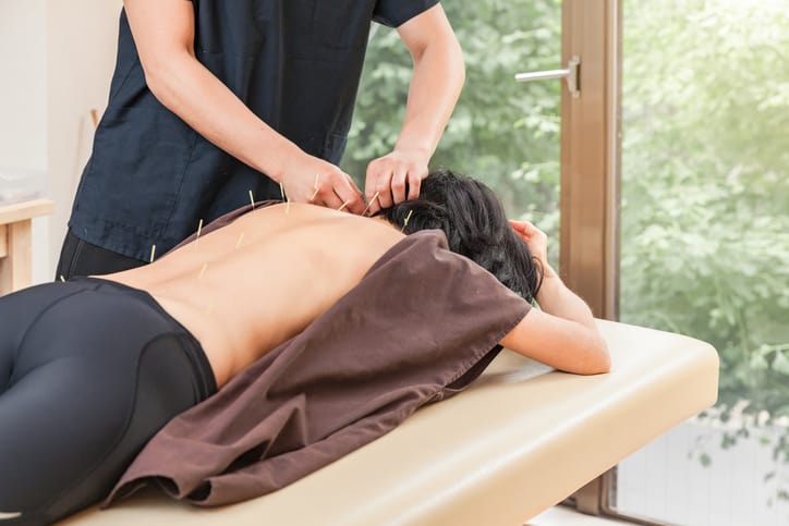 Image of a client receiving acupuncture treatment from a professional who uses an acupuncturist answering service